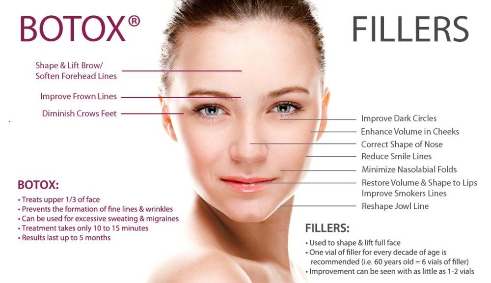 Dermal Fillers