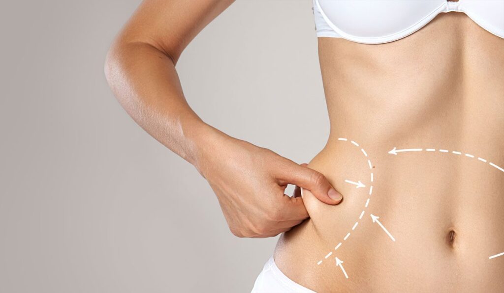 Fat Removal